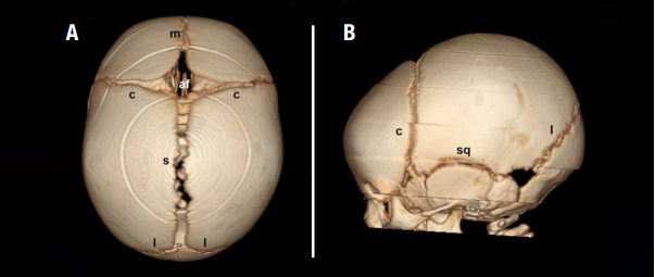 normal sutures