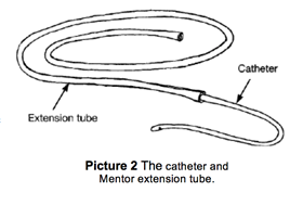 Catheter