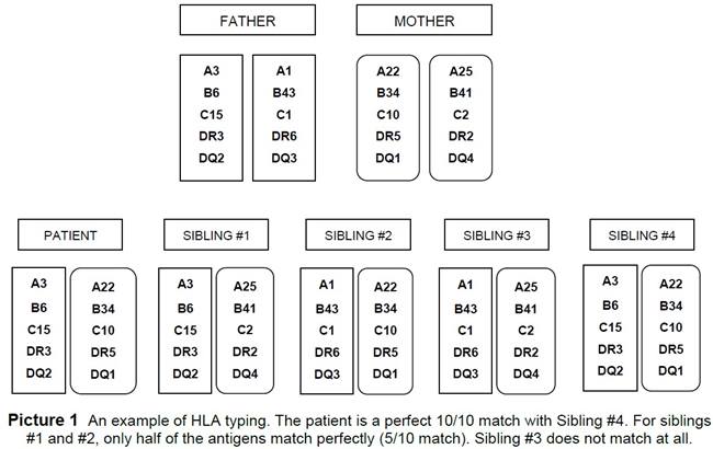 an example of HLA Typing