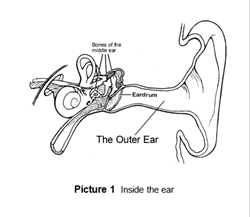 Otitis Externa (Swimmer’s Ear)