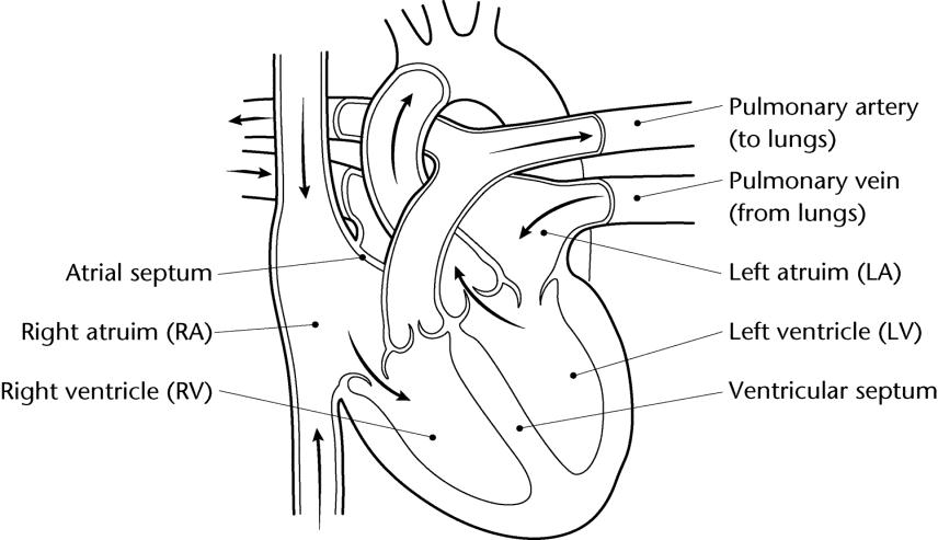 A normal heart after the ductus arteriosus blood vessel has closed
