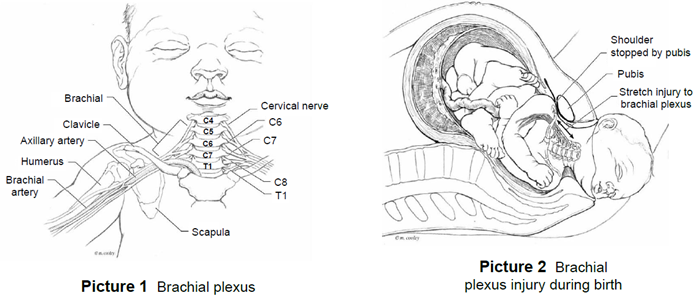brachial plexus diagram