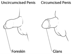 a circumciced and uncircumciced penis