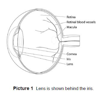 Lens is shown behind the iris