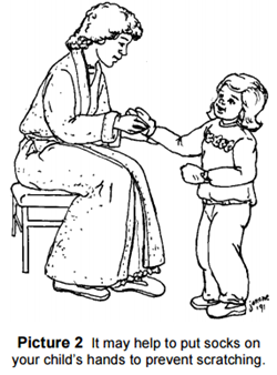 put socks on your child’s hands to prevent scratching