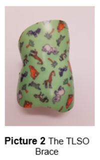 TLSO brace