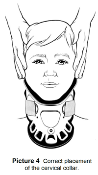 This shows correct placement of the cervical collar