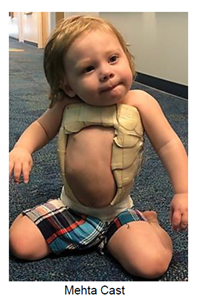 Young child wearing a mehta cast