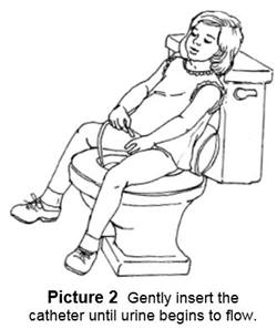 How to Insert Catheter