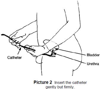 Inserting Catheter