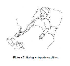 Child having Impedance Test Done