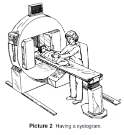 image of having a cystogram