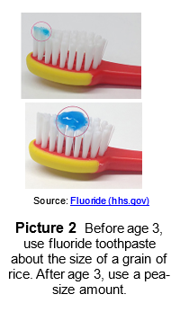 Before age 3, use fluoride toothpaste about the size of a grain of rice. After age 2, use a pea-size amount.
