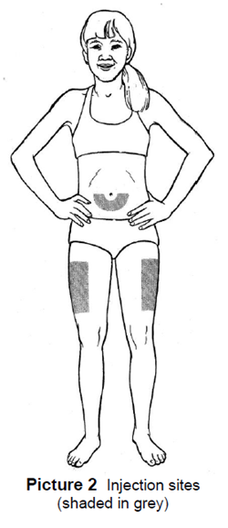 Illustration showing injection sites
