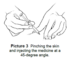 Pinching the skin and injecting the medicine at a 45-degree angle.
