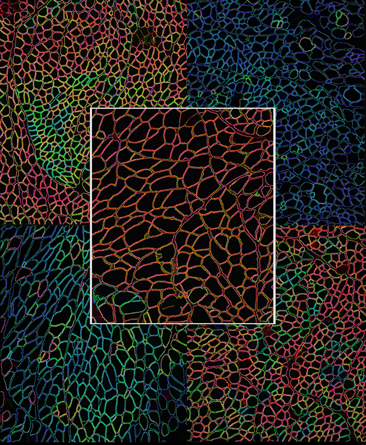 Wellstone Muscular Dystrophy Specialized Research Center 