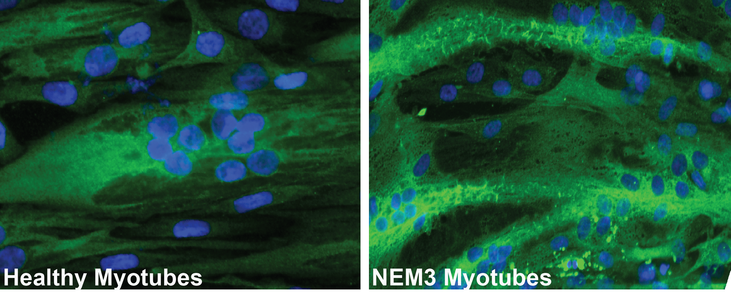 Investigating the disease mechanism of ACTA1-related Nemaline myopathy through the generation of a new mouse model and developing gene therapy for this condition