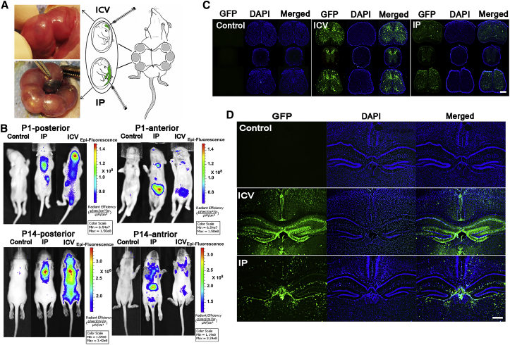 Prenatal Gene Therapy figure