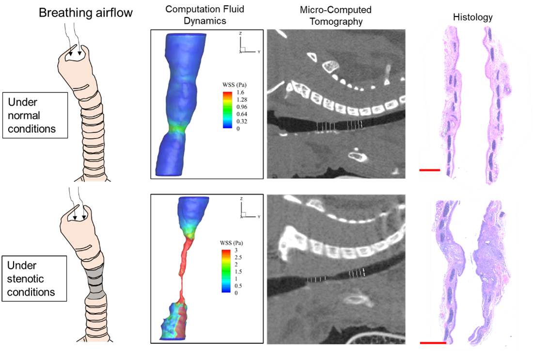 Computational modeling being used to study the airway during varying conditions.