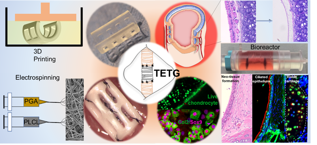 Designing tracheal grafts