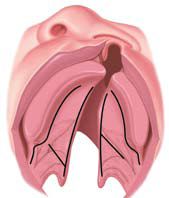 Cleft Palate Surgery