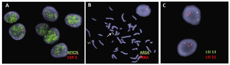 IGM Fluorescence in situ Hybridization (FISH)