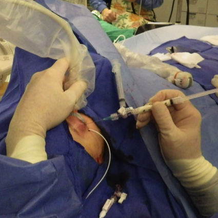 James Murakami, MD presentation