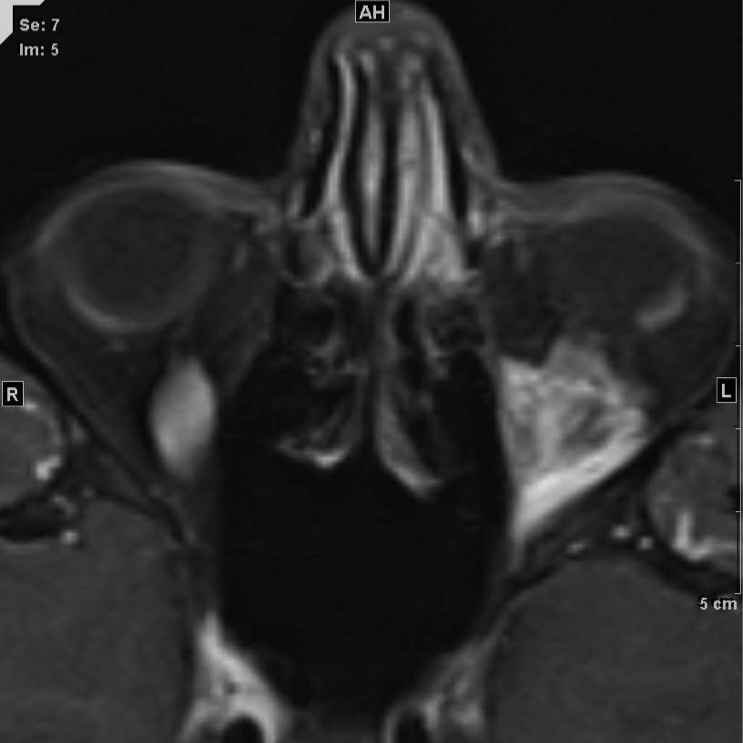 James Murakami, MD presentation