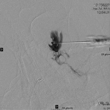 James Murakami, MD presentation