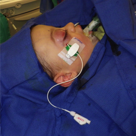 Jim Murakami, MD, ISSVA Presentation