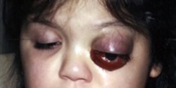 James Murakami, MD presentation