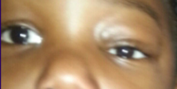 James Murakami, MD presentation